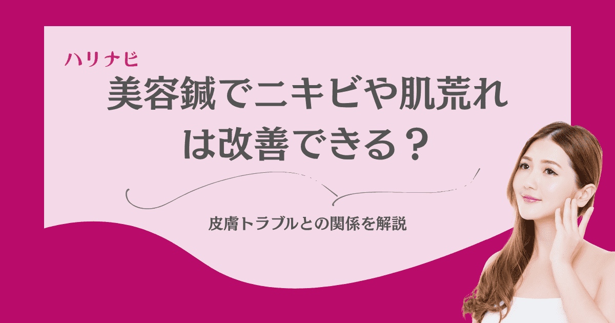 美容鍼でニキビや肌荒れは改善できる？皮膚トラブルとの関係を解説