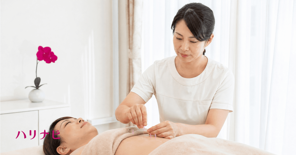不妊鍼灸の施術を受ける女性と、体に鍼を施す鍼灸師の手元のイメージ